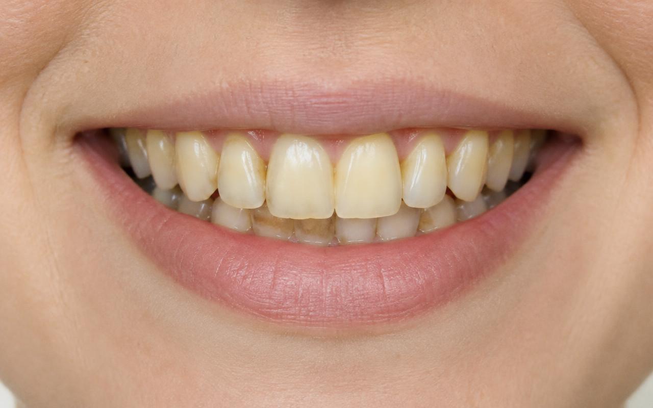 Illustrative example before cosmetic treatment